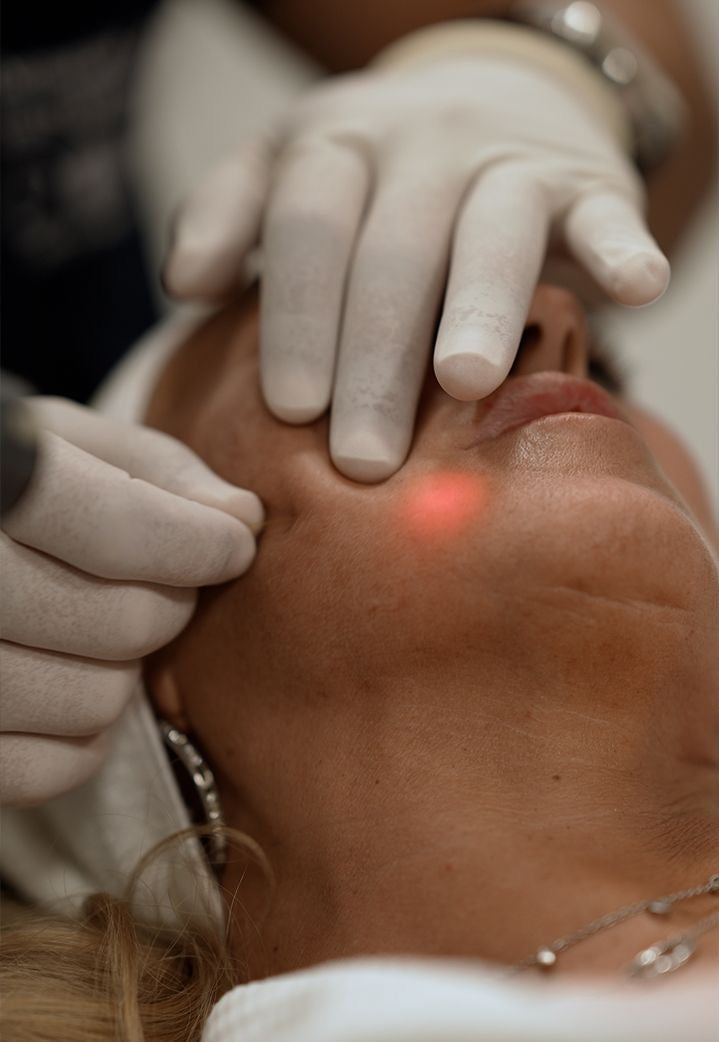 Endolift