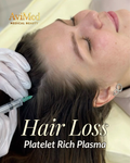 Platelet-Rich Plasma - Hair
