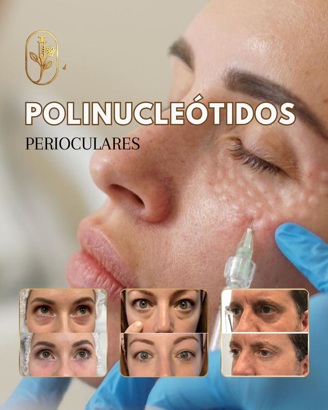 Sesión de Polinucleótidos