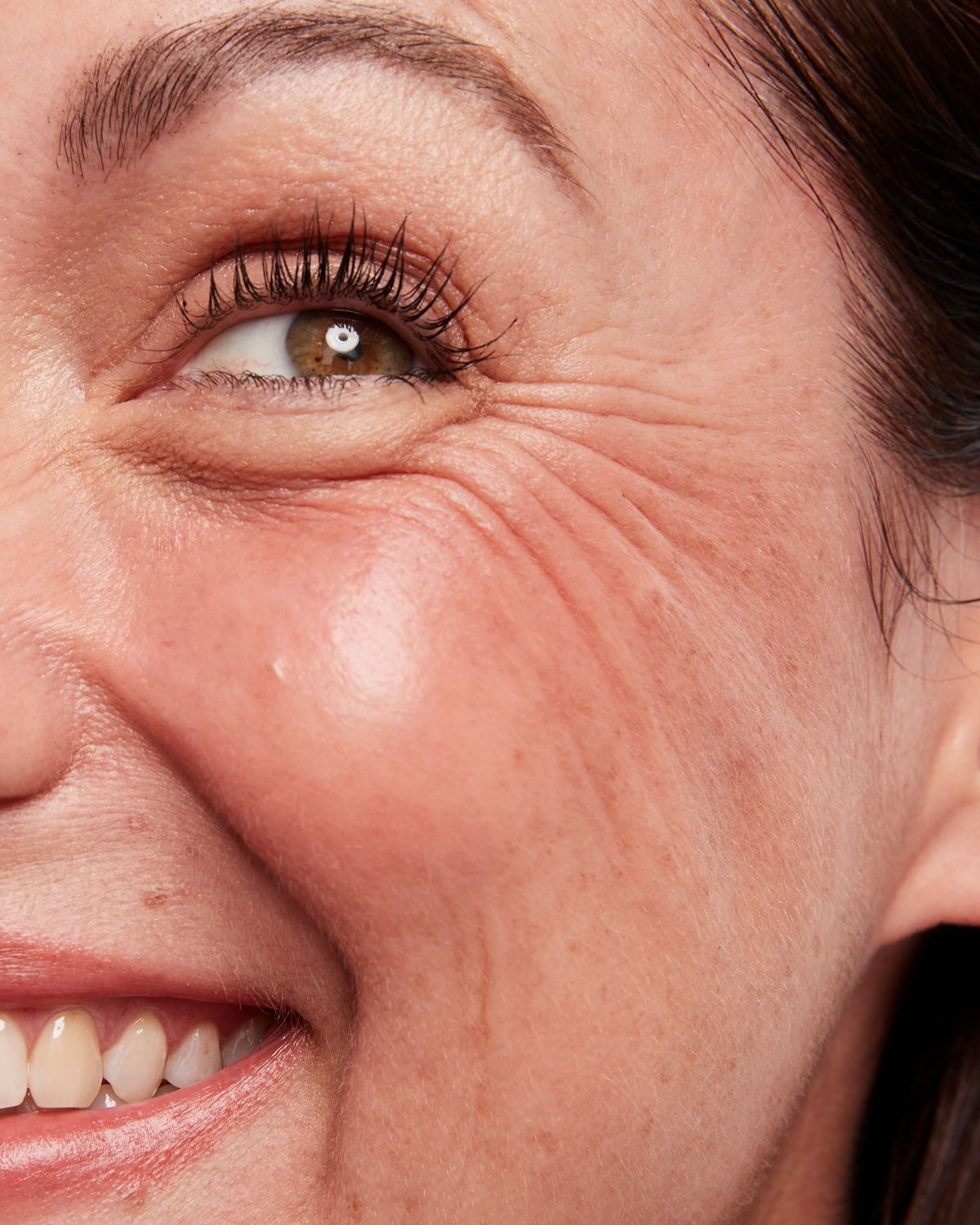 Toxina Botulínica - Facial