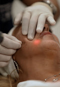 Lifting Facial - Endolift
